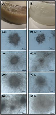 Tolerance to Abiotic Factors of Microsclerotia and Mycelial Pellets From Metarhizium robertsii, and Molecular and Ultrastructural Changes During Microsclerotial Differentiation